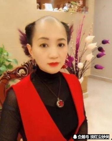 明星网红秃头假发,明星假发生态解析