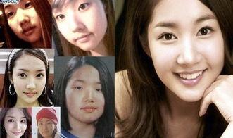 明星网红整容前后,揭秘明星网红整容前后的惊人变化